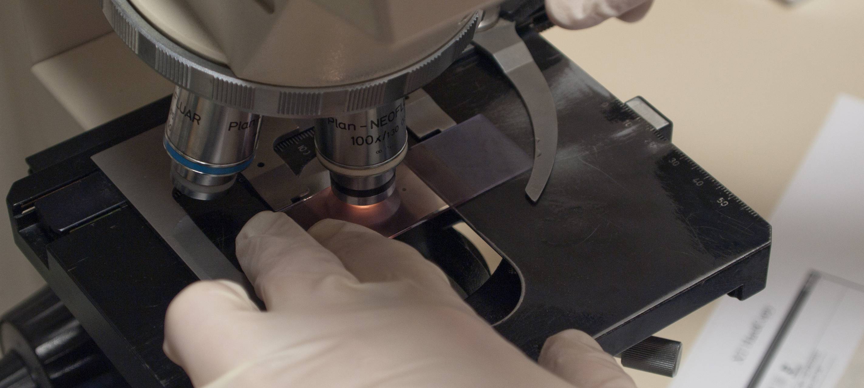 Mediziner aus Essen erforschen Corona