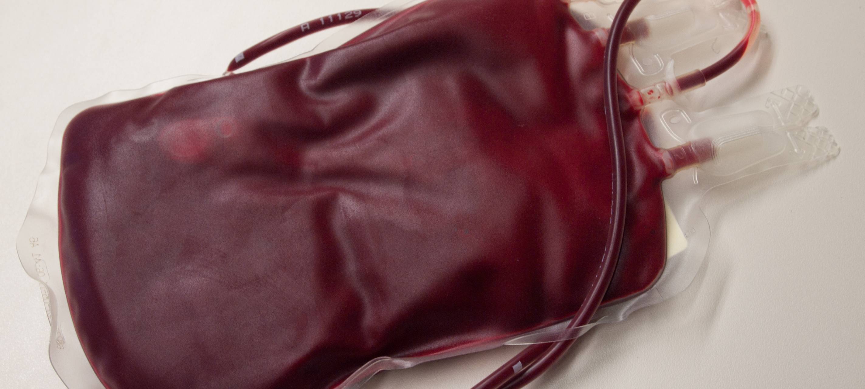 Blutspender können noch spontan kommen