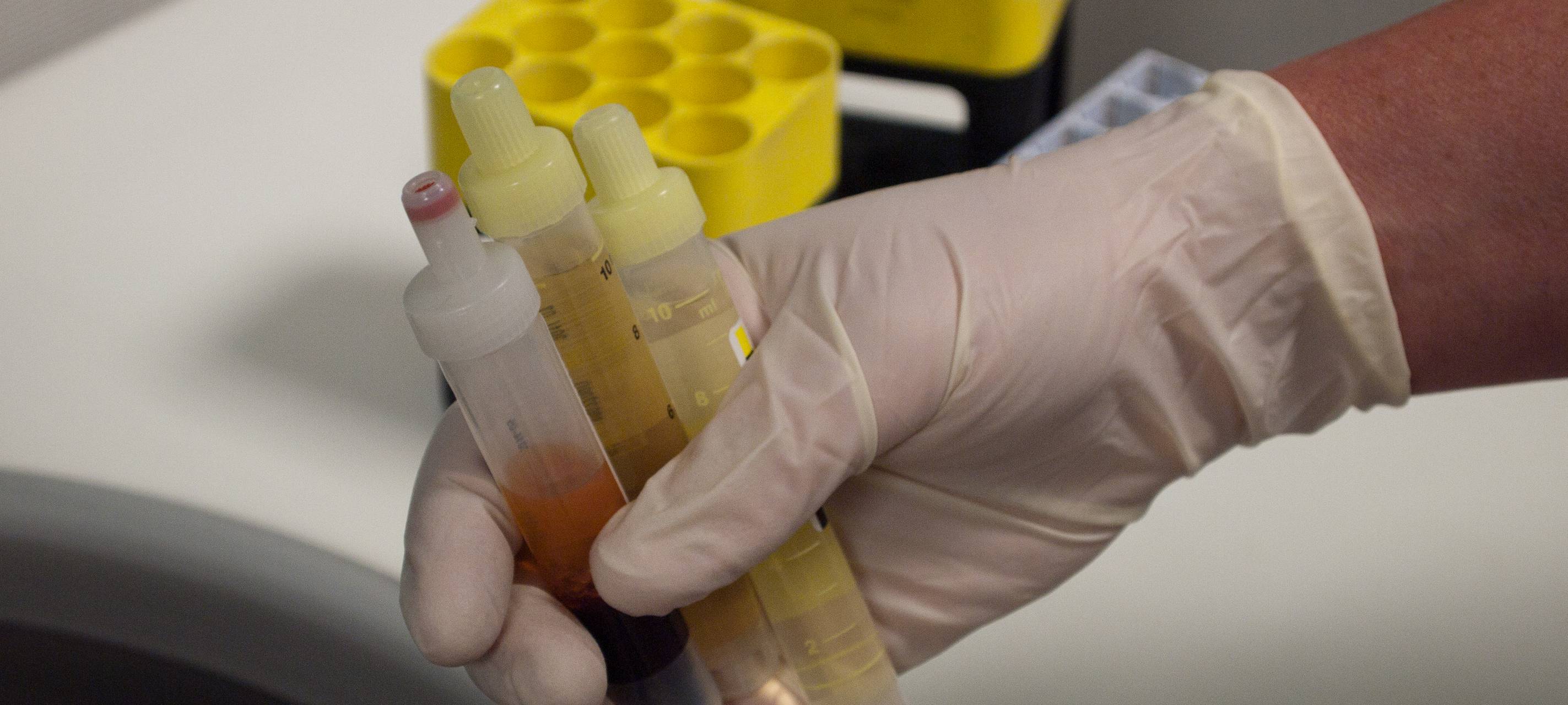 Stadt Essen gibt Omikron-Entwarnung