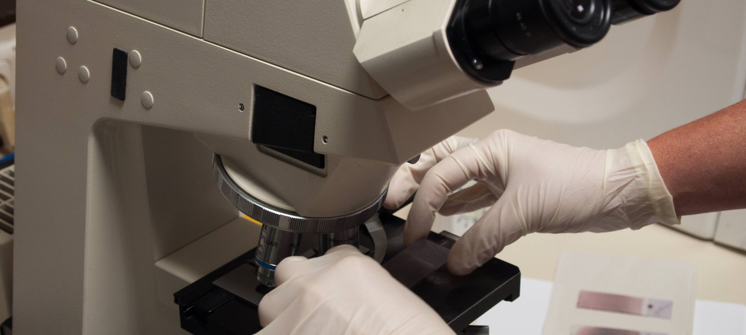 Verdacht auf "Omikron" in Essen